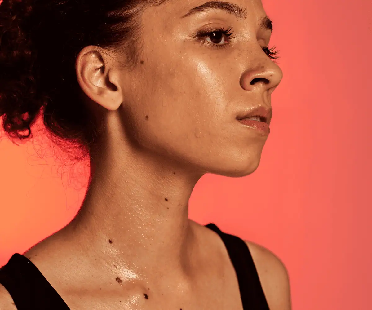 Moedervlek verwijderen