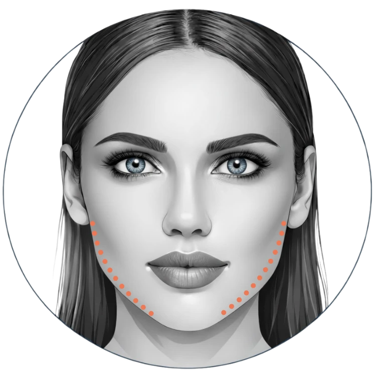 Kaaklijn met fillers