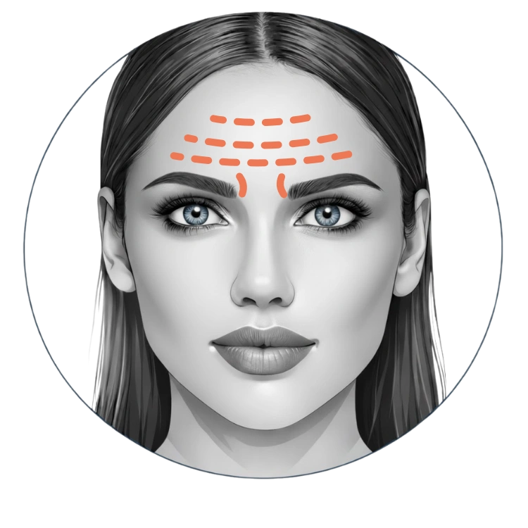 Migraine behandeling